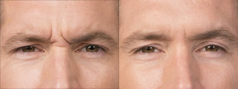 Before and After Image