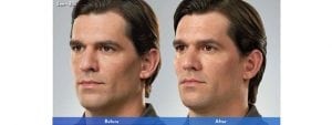 Before and After Image