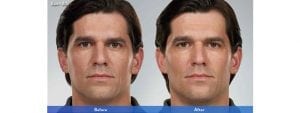 Before and After Image