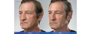 Before and After Image